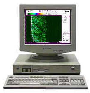 ультразвуковой сканер кожи Skinscanner DUB 1996